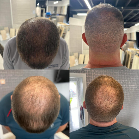 hair boom (pre-rebrand)